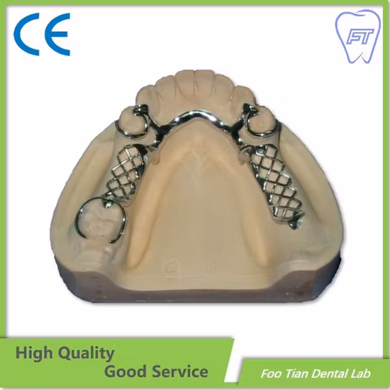 Cast Partial Framework Removable Denture Dental