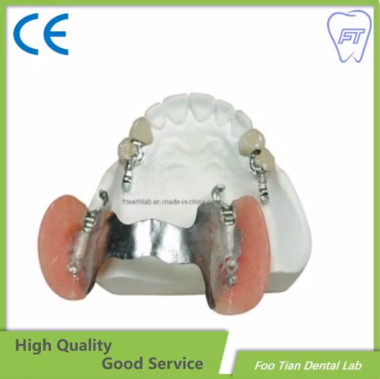 Cobalt Chrome Casting Framework Removable Denture Customized