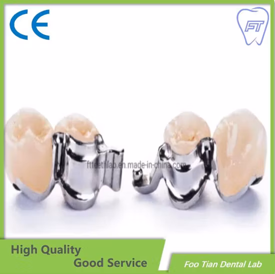 Cobalt Chrome Casting Framework Removable Denture Customized