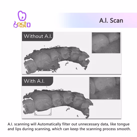 세련된 의료 제품 교정용 3D 치과 스캐너