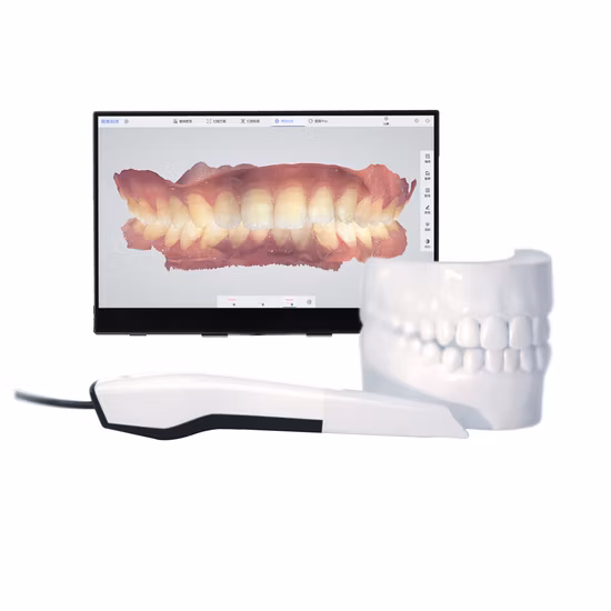 ICEN Cad Cam 디지털 치과 구강 내 3d 스캐너 구강 내 스캔 치과 실험실 무료 소프트웨어가 포함 된 미니 휴대용 스캐너