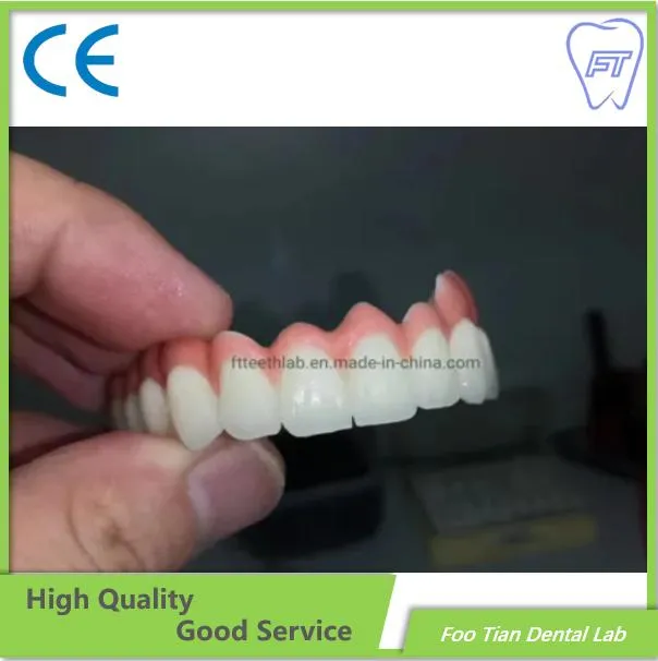 중국 심천의 Foo Tian Dental Lab에서 만든 좋은 서비스 치과용 금속 세라믹 크라운
